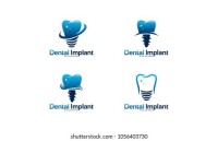 Dental implant partners