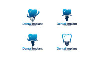 The dental implant place